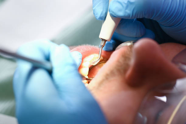 Best Weekend Emergency Dentist in Eastover, NC