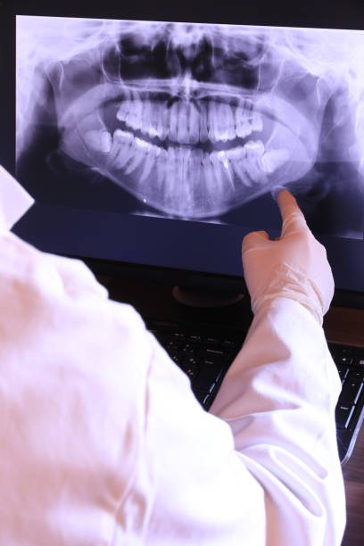 Best Emergency Tooth Extraction in Eastover, NC