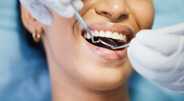 Best Emergency Broken Tooth Repair in Eastover, NC